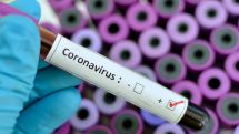 78 bestätigte Corona-Infektionsfälle im Kreis Paderborn